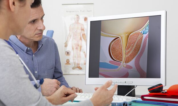 Een arts raadplegen als er pathologische afscheiding uit de penis is